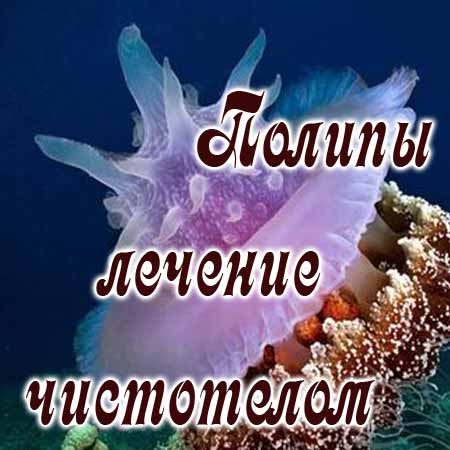 Полип
